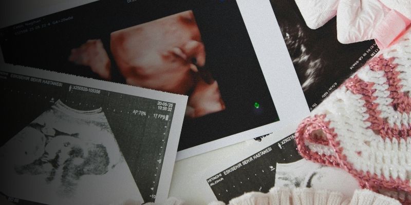 Professionele pretecho's met persoonlijke aandacht.