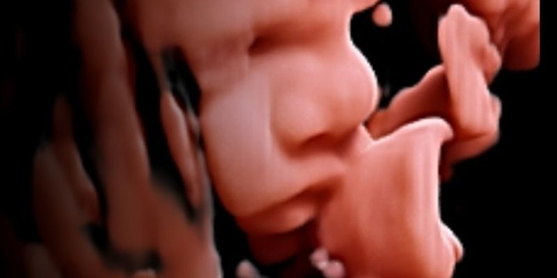 Vroege echo’s, geslachtsbepalingen én gedetailleerde 3D/4D-beelden.